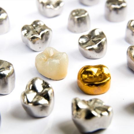 Dental crowns made from different materials