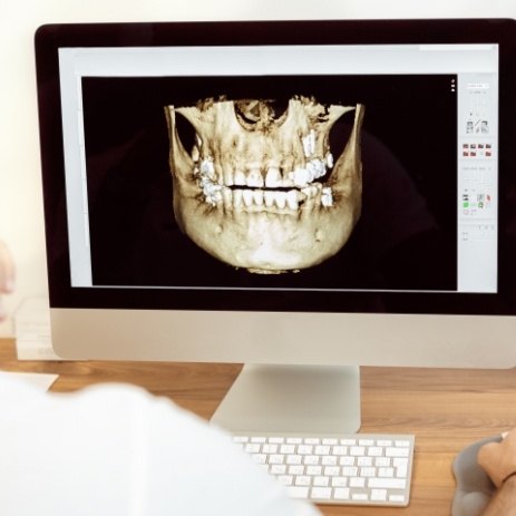 Panoramic digital dental x-rays on computer screen