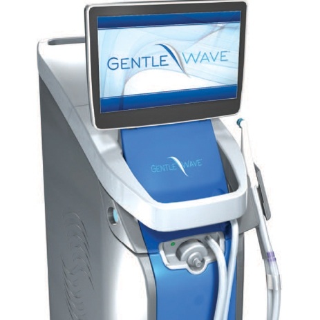 Gentle Wave endodnotic treatment system