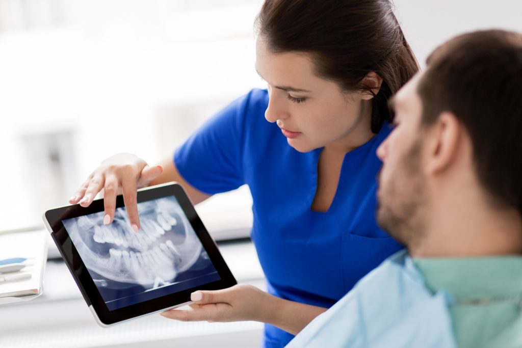Endodontist showing patient X-ray