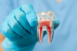 a closeup of a model of a tooth’s anatomy